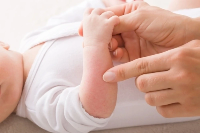cara menghilangkan bentol alergi pada bayi